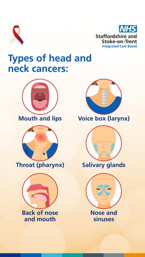 Head and neck cancer social media and web images 1920x1080 01